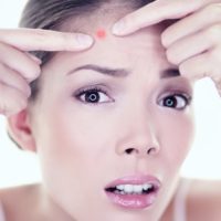 Прыщи на лице