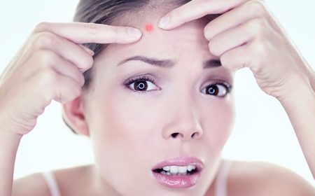 Прыщи на лице