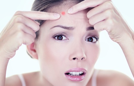  Прыщи на лице