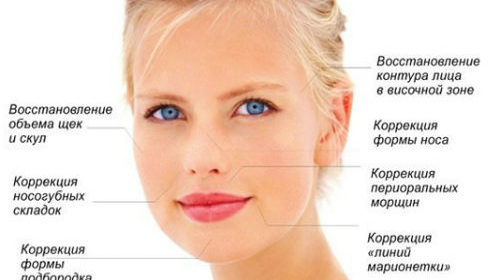 Карбокситерапия